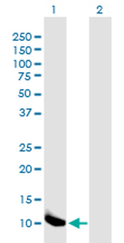 B2M monoclonal antibody (M01J), clone 3F9-2C2