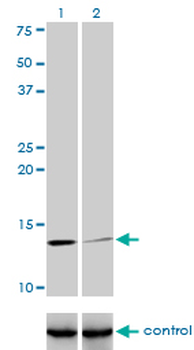 B2M monoclonal antibody (M01J), clone 3F9-2C2