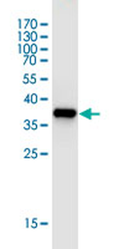 B2M monoclonal antibody (M01J), clone 3F9-2C2