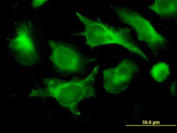 B2M monoclonal antibody (M01), clone 3F9-2C2