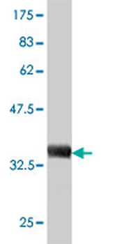 B2M monoclonal antibody (M01), clone 3F9-2C2