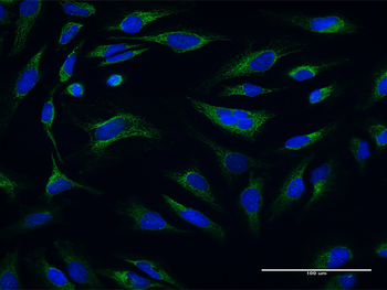 ATP5O purified MaxPab mouse polyclonal antibody (B01P)