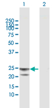 ATP5O purified MaxPab mouse polyclonal antibody (B01P)