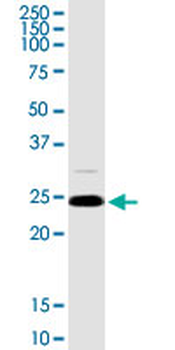 ARHGDIA MaxPab rabbit polyclonal antibody (D03)