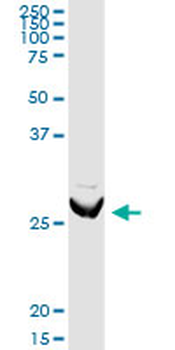 ARHGDIA MaxPab rabbit polyclonal antibody (D03)