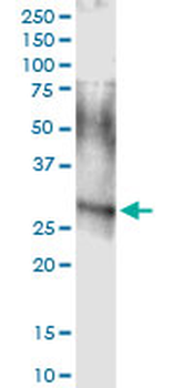 ARHGDIA MaxPab rabbit polyclonal antibody (D03)