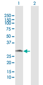 ARHGDIA MaxPab rabbit polyclonal antibody (D03)