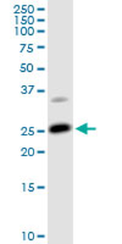 ARHGDIA MaxPab rabbit polyclonal antibody (D01)