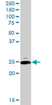 ARHGDIA MaxPab rabbit polyclonal antibody (D01)