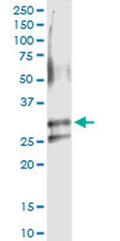 ARHGDIA MaxPab rabbit polyclonal antibody (D01)