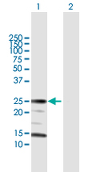 ARHGDIA MaxPab rabbit polyclonal antibody (D01)