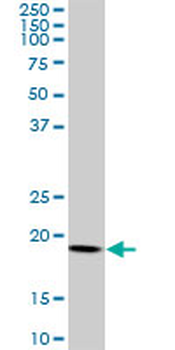 ARF5 monoclonal antibody (M01), clone 1B4