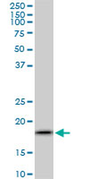 ARF5 monoclonal antibody (M01), clone 1B4