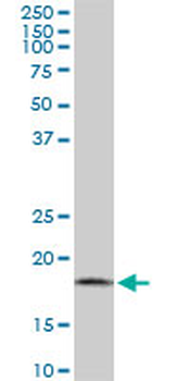 ARF5 monoclonal antibody (M01), clone 1B4