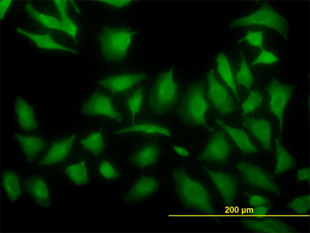 ARF5 monoclonal antibody (M01), clone 1B4