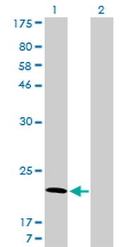 ARF5 monoclonal antibody (M01), clone 1B4