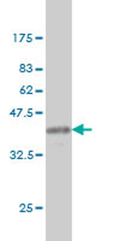 ARF5 monoclonal antibody (M01), clone 1B4