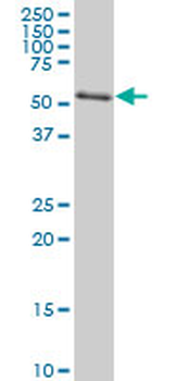 AKT2 monoclonal antibody (M06), clone X1