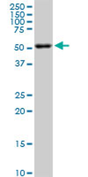 AKT2 monoclonal antibody (M06), clone X1