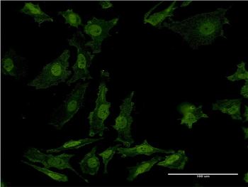 AKT2 monoclonal antibody (M06), clone X1