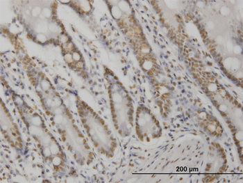 AKT2 monoclonal antibody (M06), clone X1