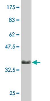 AKT2 monoclonal antibody (M06), clone X1