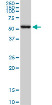 AKT1 monoclonal antibody (M09), clone 6F11