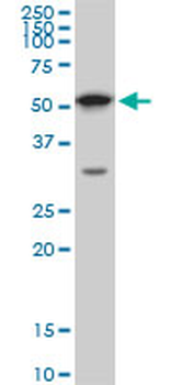 AKT1 monoclonal antibody (M09), clone 6F11