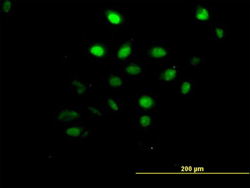 AKT1 monoclonal antibody (M09), clone 6F11