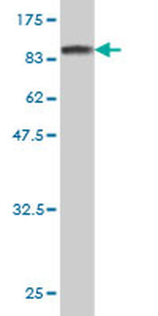 AKT1 monoclonal antibody (M09), clone 6F11