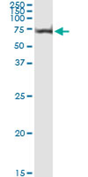 AKT1 monoclonal antibody (M03), clone 2E11