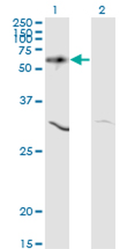 AKT1 monoclonal antibody (M03), clone 2E11