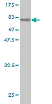 AKT1 monoclonal antibody (M03), clone 2E11