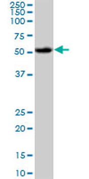 AKT1 monoclonal antibody (M03), clone 2E11