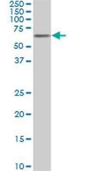 AKT1 monoclonal antibody (M03), clone 2E11