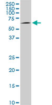 AKT1 monoclonal antibody (M03), clone 2E11