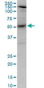 AKT1 monoclonal antibody (M03), clone 2E11