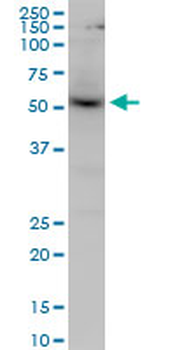 AKT1 monoclonal antibody (M03), clone 2E11