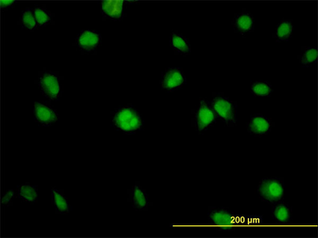 AKT1 monoclonal antibody (M03), clone 2E11