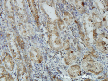 AKT1 monoclonal antibody (M03), clone 2E11