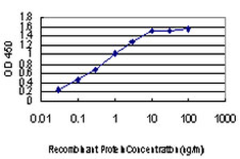 ACVR1B monoclonal antibody (M09), clone 1C1