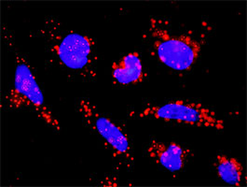 ACVR1B monoclonal antibody (M09), clone 1C1