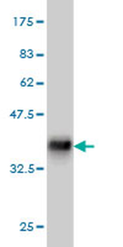 ACVR1B monoclonal antibody (M09), clone 1C1