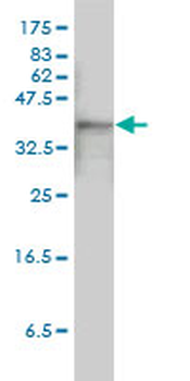 ACTB monoclonal antibody (M01), clone 3G4-F9