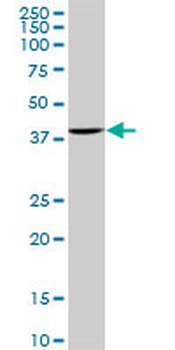 ACTB monoclonal antibody (M01), clone 3G4-F9