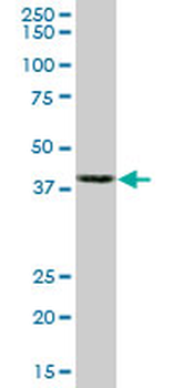 ACTB monoclonal antibody (M01), clone 3G4-F9