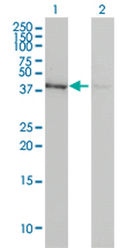 ACTB monoclonal antibody (M01), clone 3G4-F9