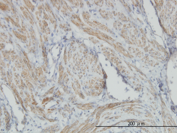 ACTB monoclonal antibody (M01), clone 3G4-F9