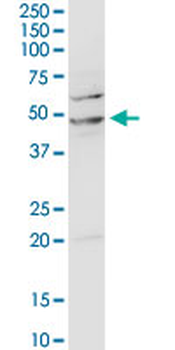 ACADM purified MaxPab rabbit polyclonal antibody (D01P)