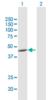 ACADM purified MaxPab rabbit polyclonal antibody (D01P)